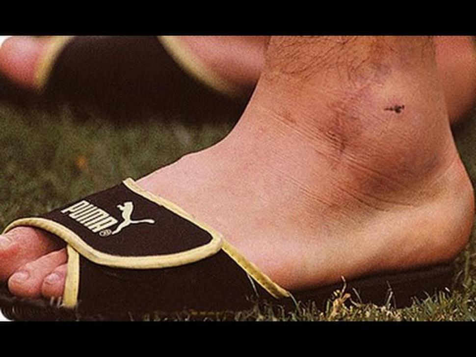  INFLAMADO. El tobillo de Maradona parecía tener en su interior una pelota de tenis.