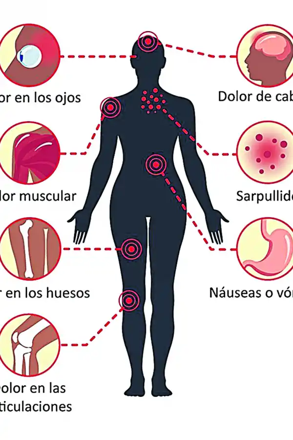 Diez mitos y errores sobre la fiebre quebrantahuesos