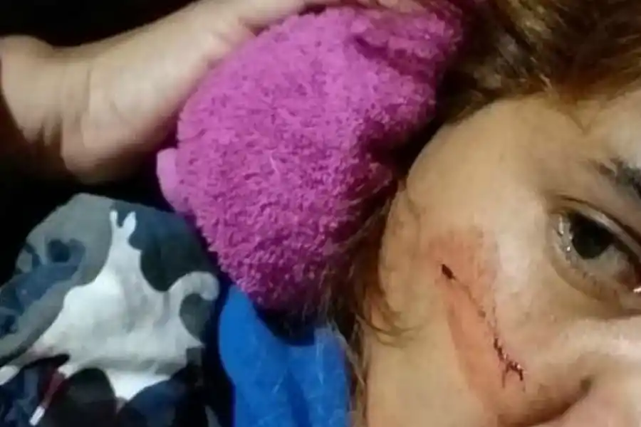 Le dispararon para robarle pero se salvó de milagro: la bala le rozó el cachete