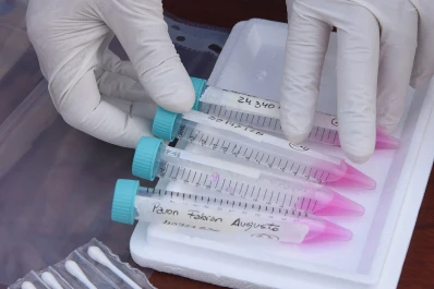 Últimos testeo: negativo en 19 casos