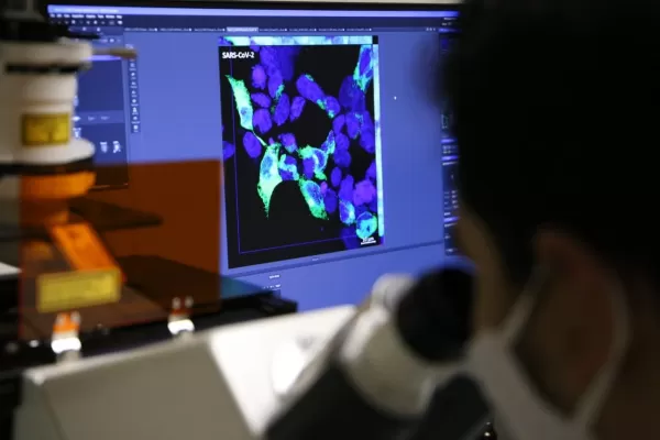 Científicos tucumanos avanzan con una investigación para el diagnóstico del coronavirus