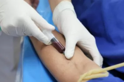 Un análisis de sangre alerta sobre el cáncer cuatro años antes