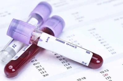 Un análisis de sangre puede detectar cáncer