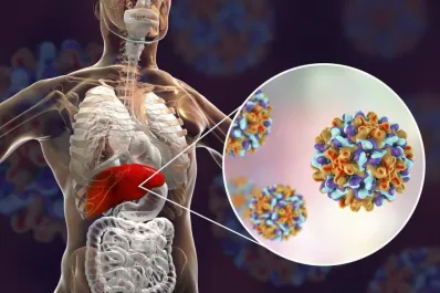 Hepatitis B y C: es clave hallar a los que ignoran estar infectados