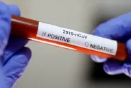 La OMS registra un nuevo récord de casos de coronavirus a nivel mundial: 290.000