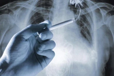 Día del cáncer de pulmón: leve baja de la mortalidad en Argentina