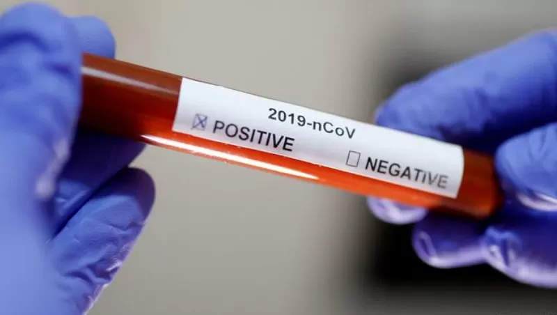 La OMS registra un nuevo récord de casos de coronavirus a nivel mundial: 290.000