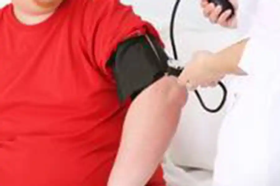 Cuáles son los mitos y demás factores que dificultan el tratamiento de la obesidad