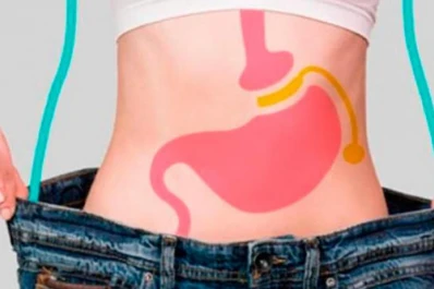 Obesidad y coronavirus: cayeron un 90% las cirugías bariátricas