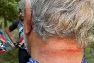 Detienen a un hombre que tenía pedido de captura y que había atacado a un endurista a machetazos