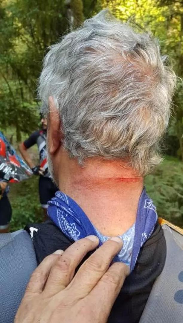 LA MARCA. La foto donde se ve el golpe de un machete que recibió el endurista Jorge Posse.  