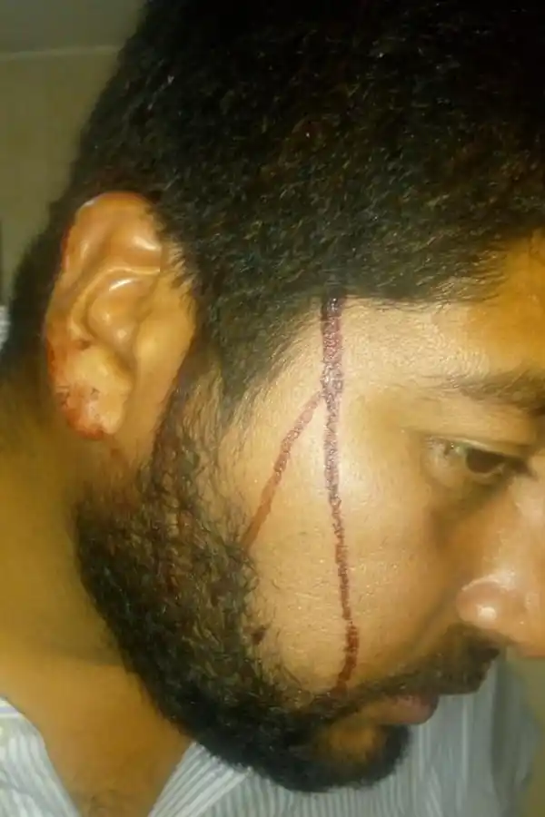 LESIONES. Eduardo Sosa denunció que lo golpearon y amenazaron.  