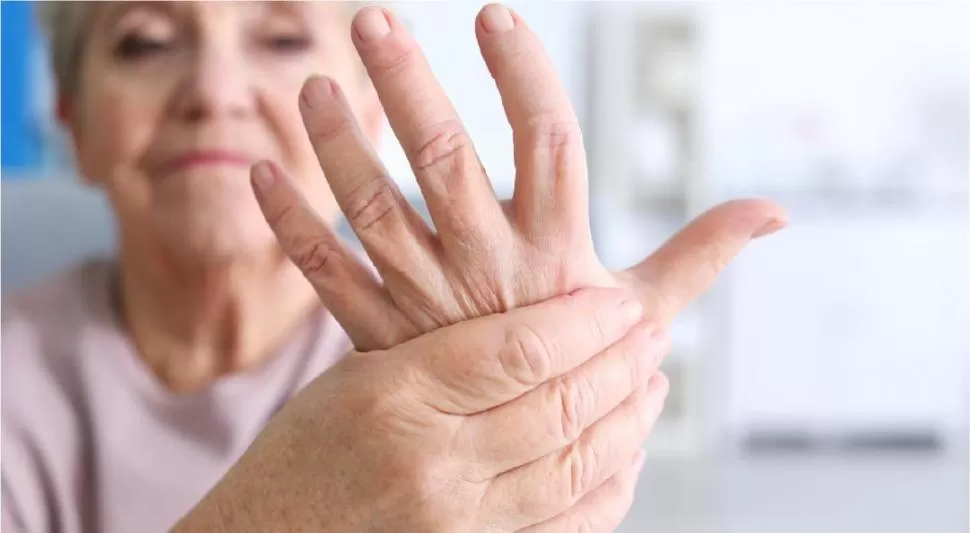 DOLOR E HINCHAZÓN. La artritis reumatoidea afecta la vida cotidiana. 