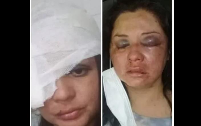 Fue brutalmente golpeada por su esposo y, tras amenazas, se fugó del Centro de Salud