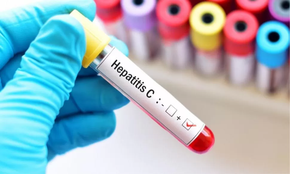 TRATAMIENTO. La hepatitis C se puede curar pero es silenciosa, por eso es importante buscar el diagnóstico. 