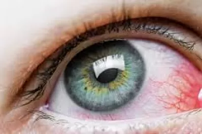 Mi hijo tiene el ojo rojo, ¿es una conjuntivitis?