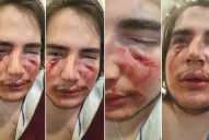 Un joven fue brutalmente atacado por tres rugbiers en una fiesta 