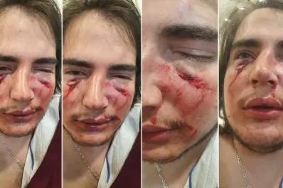 Un joven fue brutalmente atacado por tres rugbiers en una fiesta