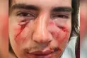 Imputan a dos rugbiers por la golpiza a un adolescente en Córdoba