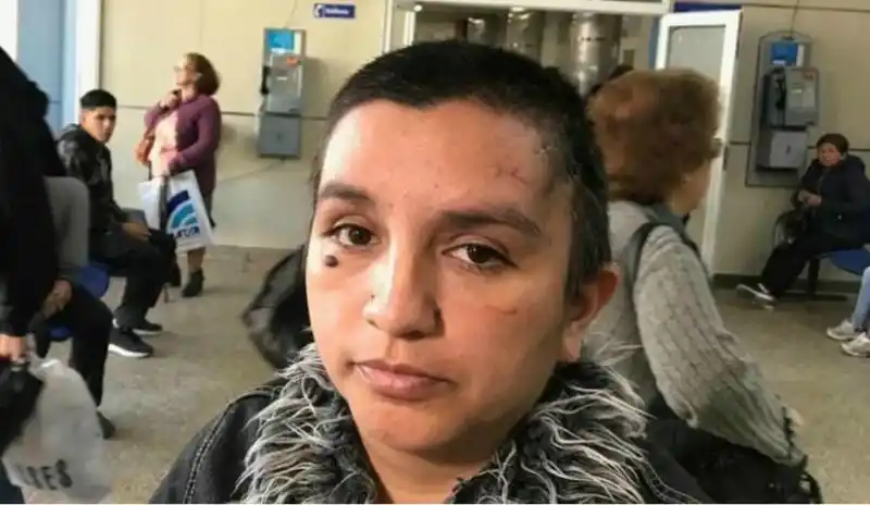 LA VÍCTIMA. Fatima Aparicio sobrevivió de milagro al ataque de su ex marido.