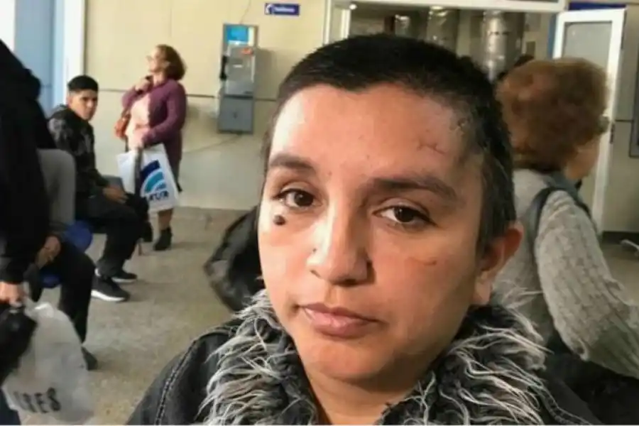 LA VÍCTIMA. Fatima Aparicio sobrevivió de milagro al ataque de su ex marido.