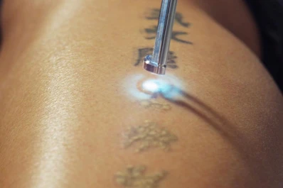 Opciones para que los tatuajes no sean para toda la vida