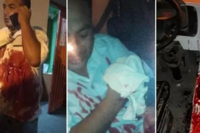 En un intento de asalto, un chofer de la línea 6 casi pierde los dedos de la mano