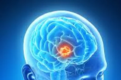 Los tumores cerebrales se originarían en lesiones