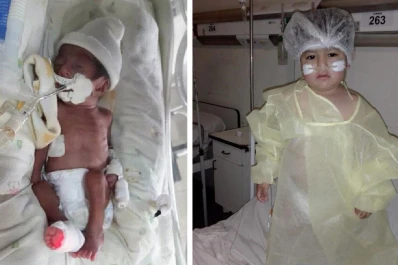 Un bebé prematuro le ganó al coronavirus y a una riesgosa operación del corazón