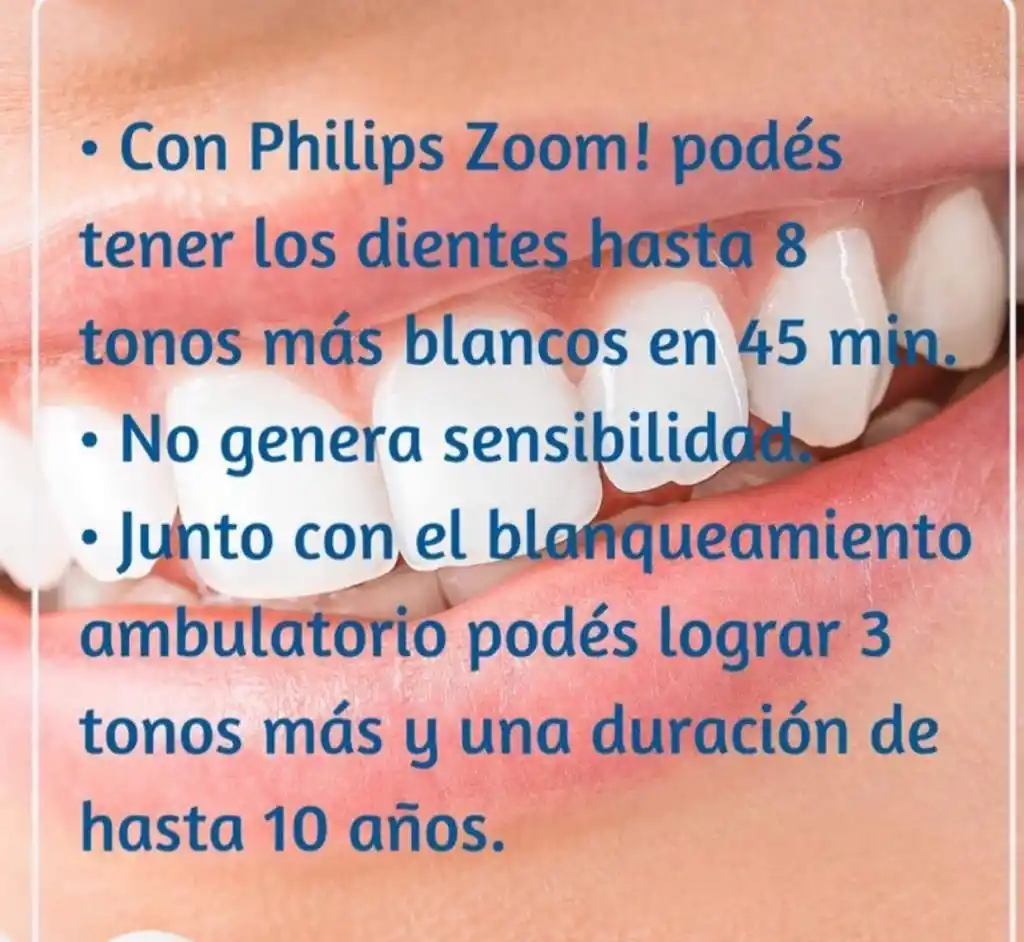 Kancyper Odontología especializada: la vanguardia en ortodoncia invisible y blanqueamiento 