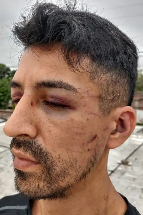 MARCAS. Iriarte muestra las heridas que le quedaron en el rostro. Abajo, la puerta rota.  