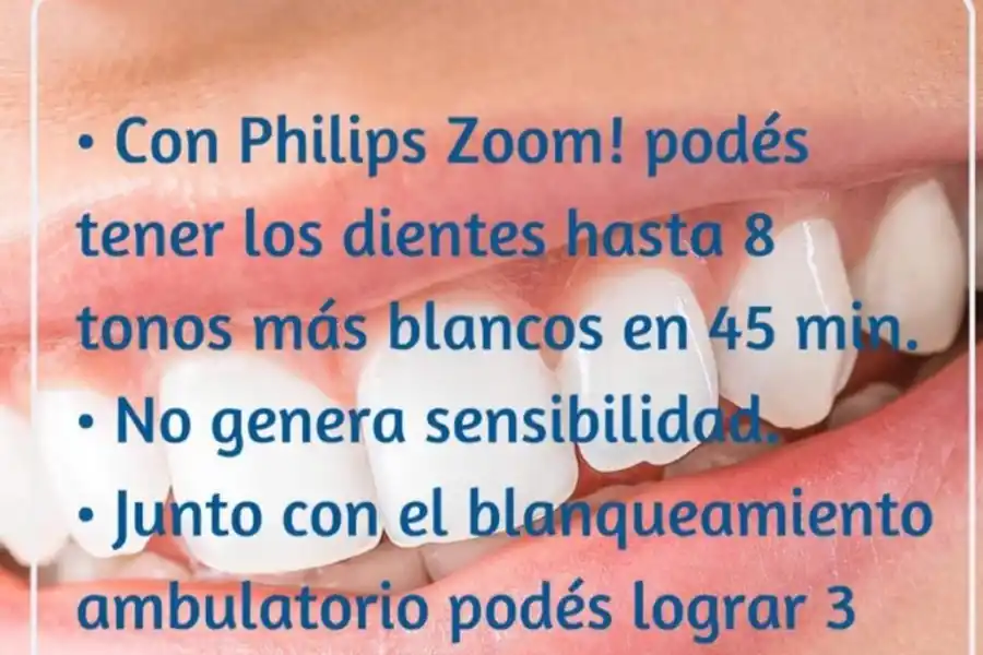 Kancyper Odontología especializada: la vanguardia en ortodoncia invisible y blanqueamiento 