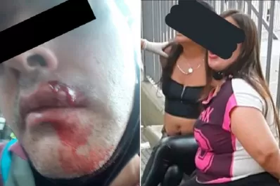 Mujeres apedrearon a un policía, porque les pidió que se pusieran el barbijo