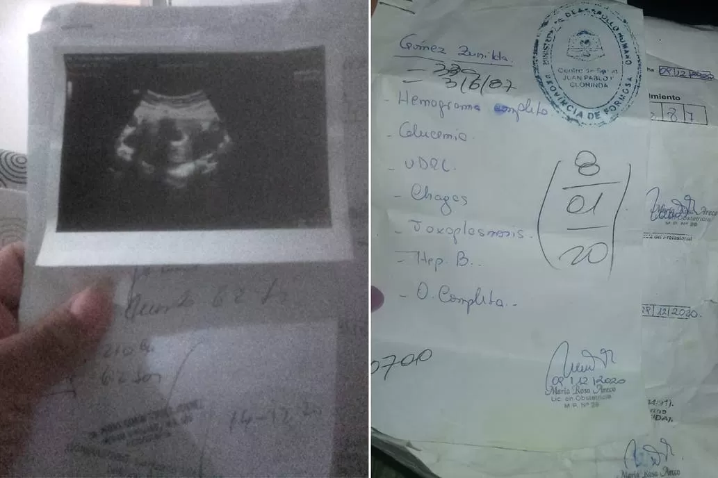 Zunilda Gómez, de Clorinda, perdió su embarazo en un centro de aislamiento Crédito: Gentileza La Nación