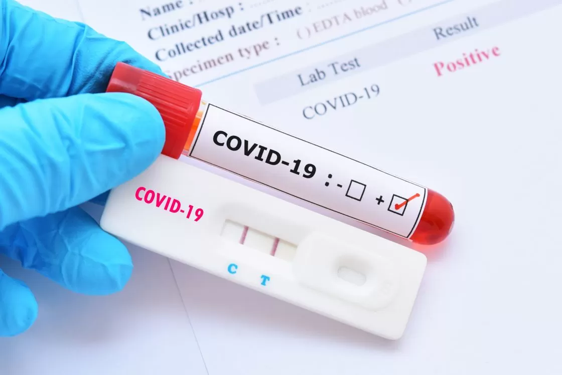 Coronavirus: estas son las vacunas que están en el mercado