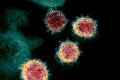 Las matemáticas de la covid: todos los virus del mundo caben en una lata de gaseosa