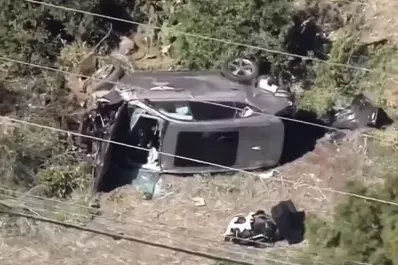 Tiger Woods resultó herido en un accidente automovilístico en Los Ángeles