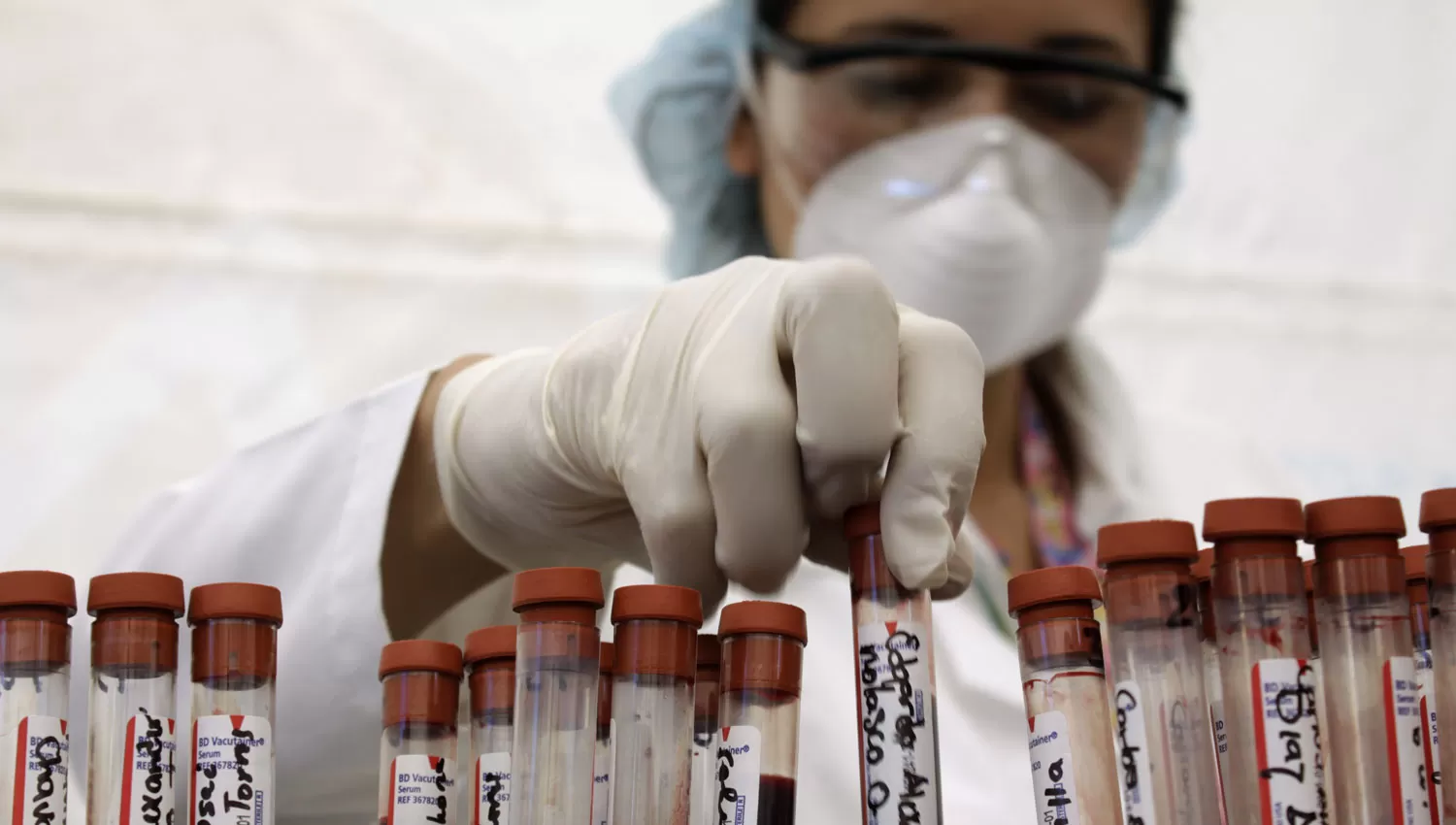 TESTEO. Una muestra de sangre permitiría que miles de infectados conozcan el diagnóstico y comiencen un tratamiento contra el HIV.