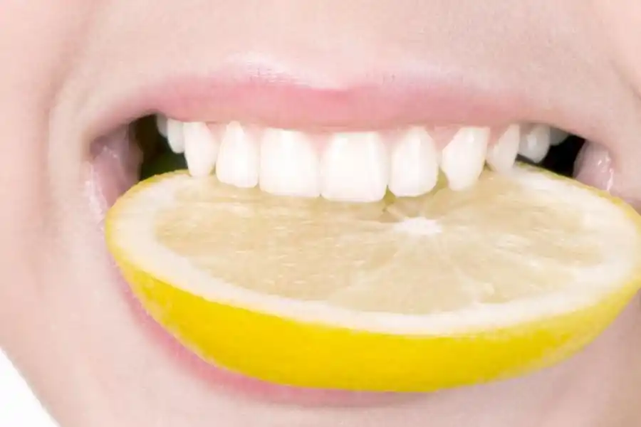 Blanqueamiento casero de dientes: más contra que pro