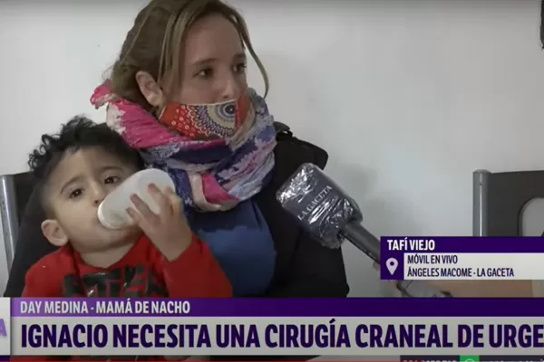 Nacho tiene un año y necesita una cirugía craneal por un defecto de nacimiento