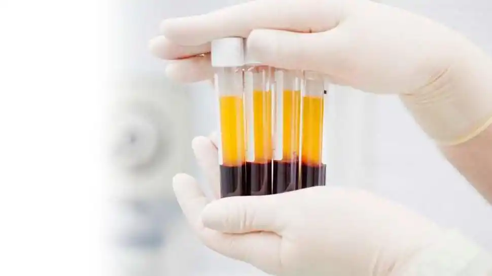 Nueva opción para combatir la caída del cabello