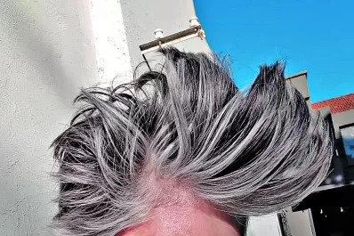 Angie Colombo: “mi pelo es mi elección”