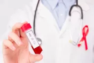 40 años de VIH: la infección se trata y no mata, pero el estigma sí