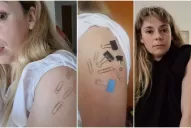 Una joven dijo que quedó con el brazo imantado tras recibir la primera dosis de la vacuna