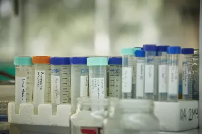 Estiman que la vacuna argentina contra la covid-19 estará en fase 1 a fines de 2022