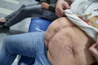 Internaron de urgencia a uno de los presuntos autores del robo a la joyería