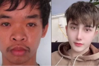 Se cansó de que lo rechacen por feo, se gastó una fortuna en cirugías plásticas y ahora es modelo