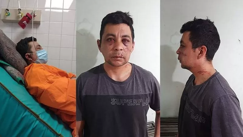 Falleció el enfermero neuquino Daniel Porro, a quien habían linchado por haberse contagiado de coronavirus. Foto: La Mañana de Neuquén