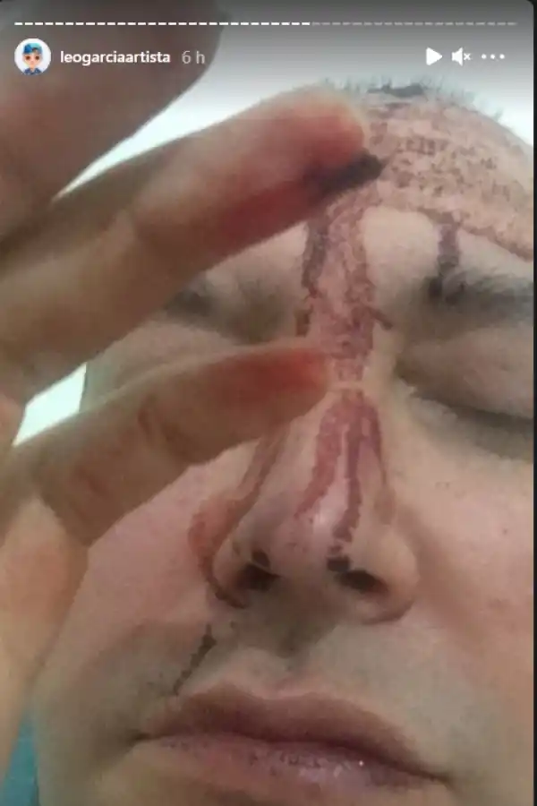 El artista Leo García sufrió una brutal paliza: Me pegaron por mi sexualidad