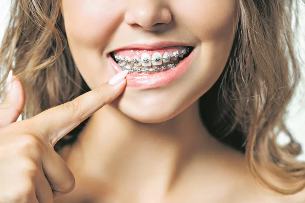 ¿Por qué es tan importante la ortodoncia?